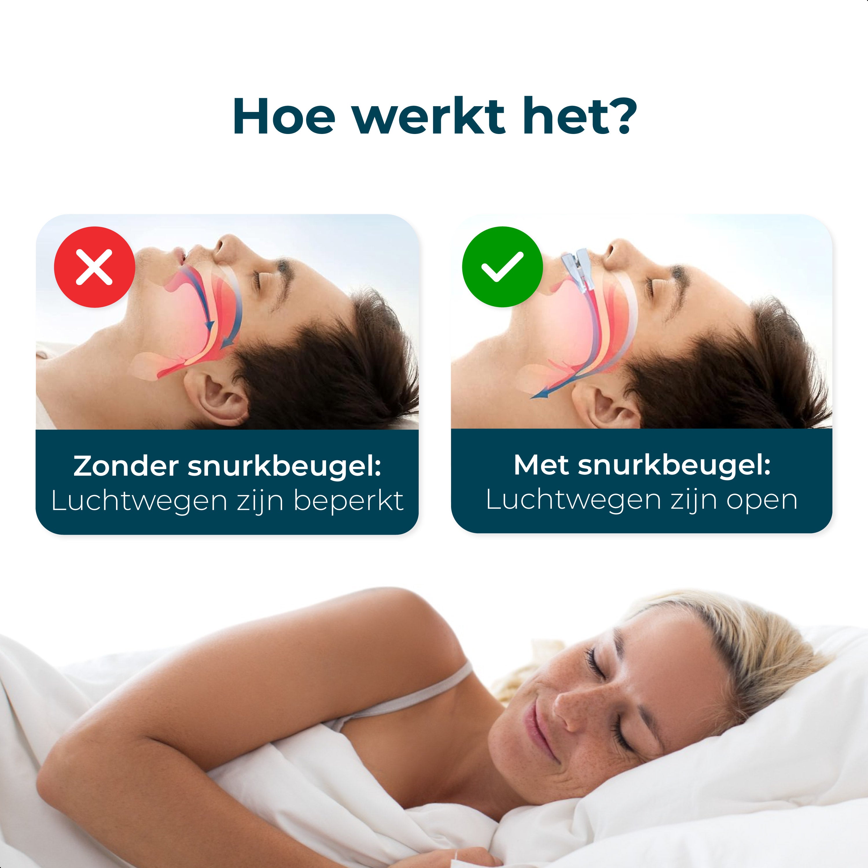 Alyze Anti Snurkbeugel Airmaster+